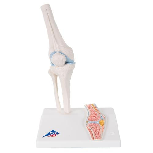 Mini-articulation du genou avec coupe transversale, sur socle - Anatomie et pathologie