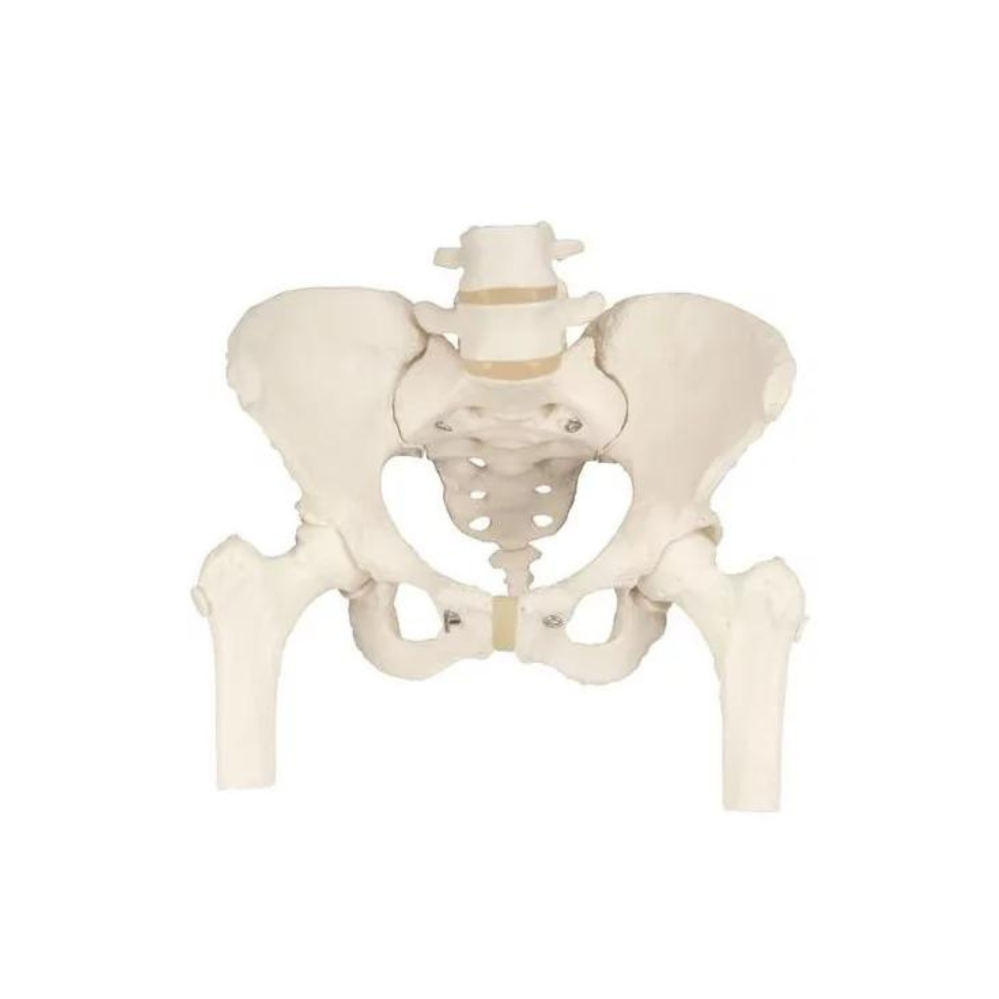 Squelette du bassin, féminin, avec moignons de fémur - Anatomie et pathologie