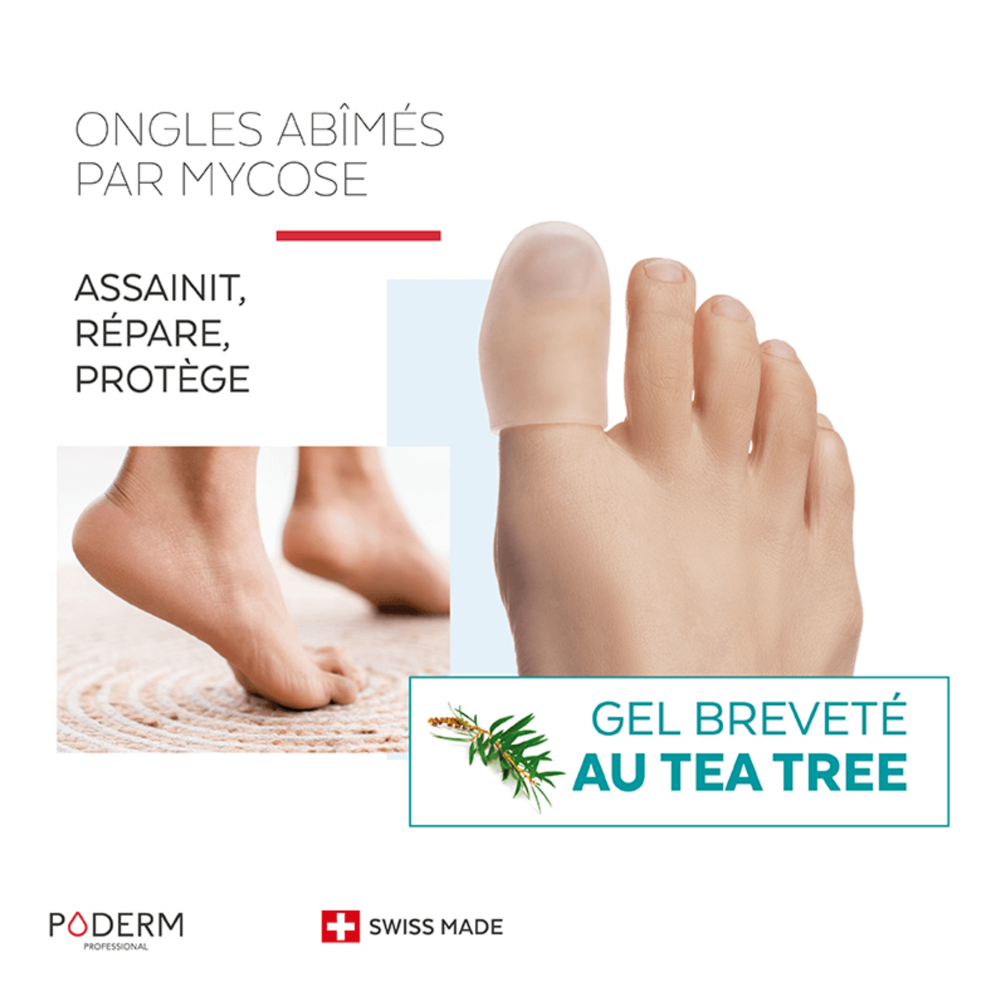 Mycose des ongles - Capuchon d'orteil Gel Tea Tree - Poderm Professional