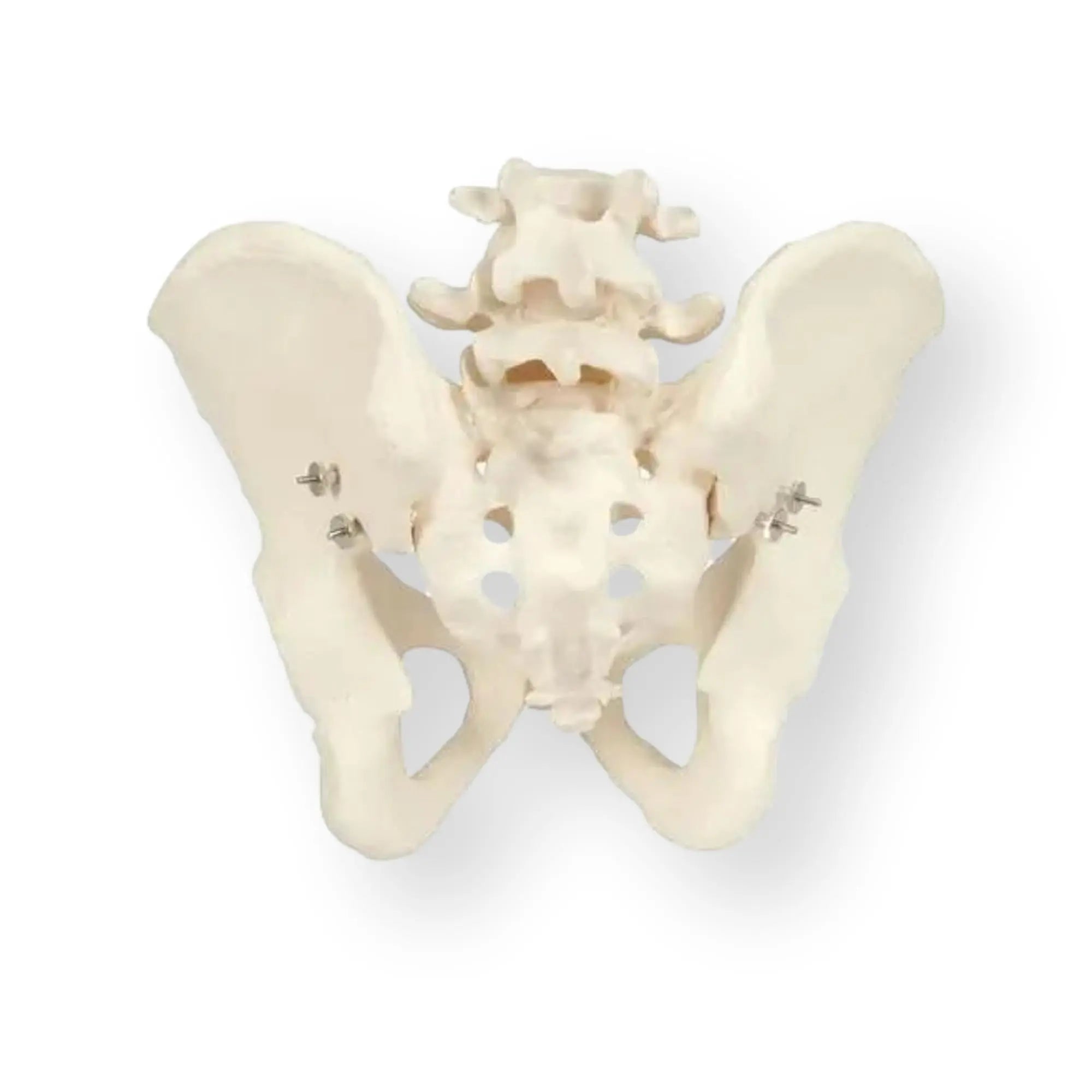 Pelvic skeleton, male - Anatomy and pathology